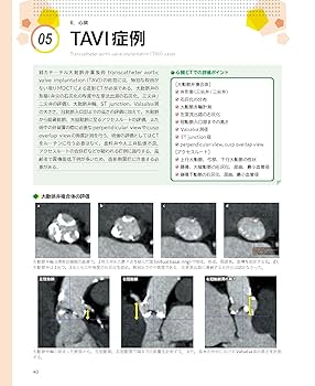 心臓 FoX_zxTaMAA_ger.jpg